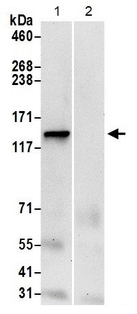Immunoprecipitation - Anti-LRPPRC/GP130 antibody (AB205022), expandable thumbnail