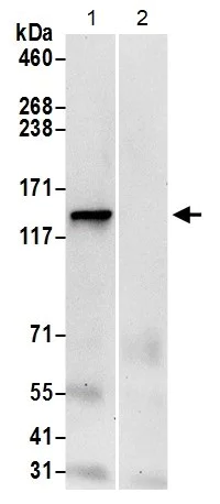 Immunoprecipitation - Anti-LRPPRC/GP130 antibody (AB205022)