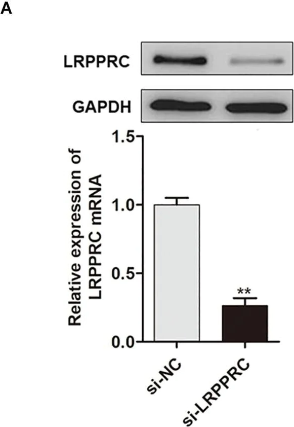 Western blot - Anti-LRPPRC/GP130 antibody (AB205022)