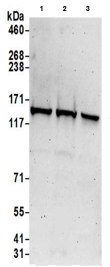 Western blot - Anti-LRPPRC/GP130 antibody (AB205022), expandable thumbnail