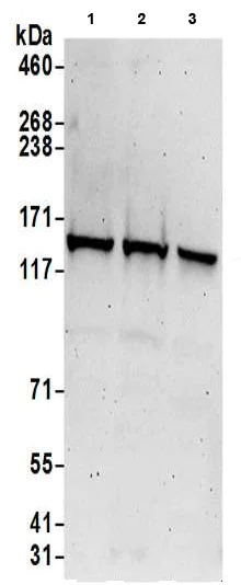 Western blot - Anti-LRPPRC/GP130 antibody (AB205022)