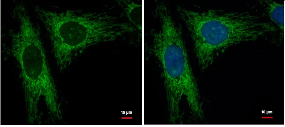 Immunocytochemistry/ Immunofluorescence - Anti-LRPPRC/GP130 antibody (AB228994)
