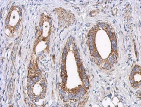 Immunohistochemistry (Formalin/PFA-fixed paraffin-embedded sections) - Anti-LRPPRC/GP130 antibody (AB228994)