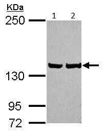 Western blot - Anti-LRPPRC/GP130 antibody (AB228994)