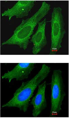 Immunocytochemistry/ Immunofluorescence - Anti-LRPPRC/GP130 antibody (AB97505)