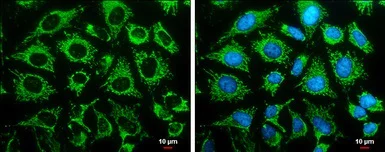 Immunocytochemistry/ Immunofluorescence - Anti-LRPPRC/GP130 antibody (AB97505)