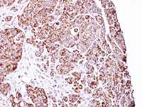 Immunohistochemistry (Formalin/PFA-fixed paraffin-embedded sections) - Anti-LRPPRC/GP130 antibody (AB97505)