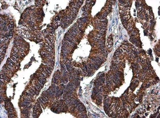 Immunohistochemistry (Formalin/PFA-fixed paraffin-embedded sections) - Anti-LRPPRC/GP130 antibody (AB97505)