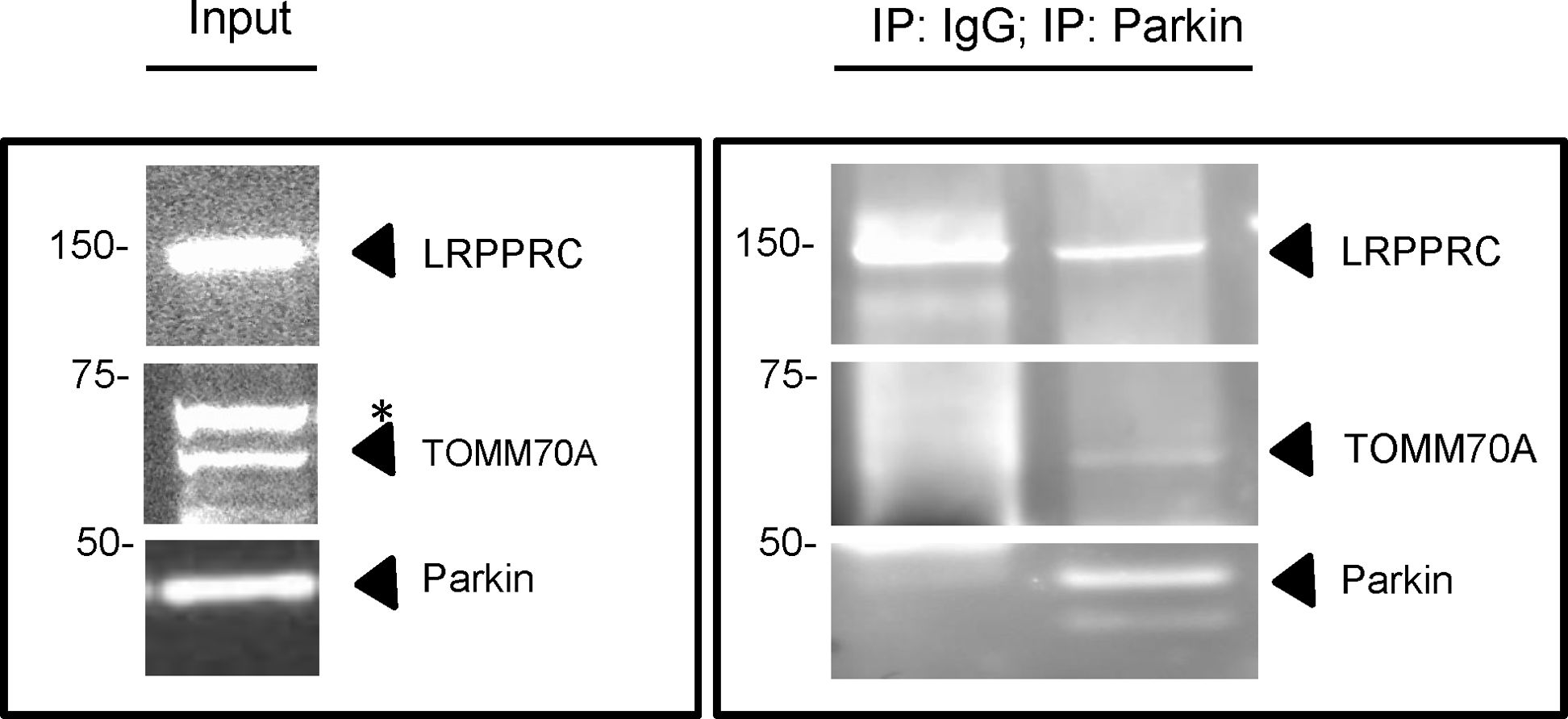 Western blot - Anti-LRPPRC/GP130 antibody (AB97505), expandable thumbnail