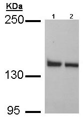 Western blot - Anti-LRPPRC/GP130 antibody (AB97505), expandable thumbnail