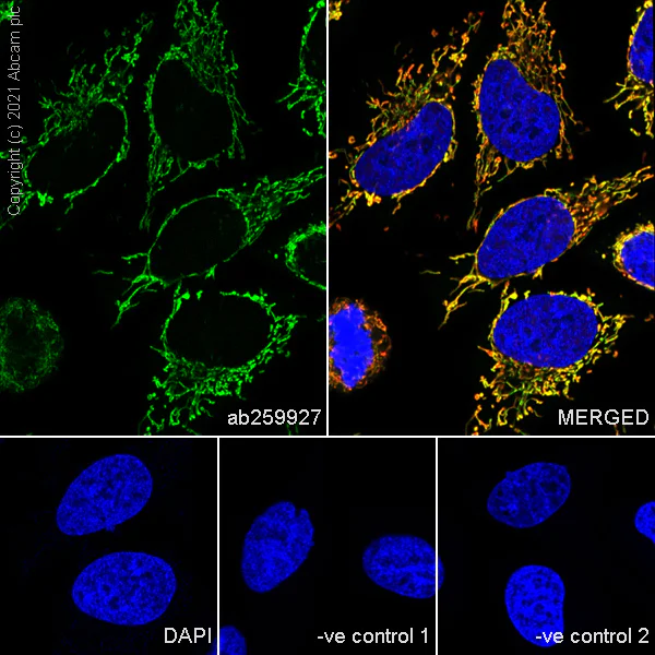 Immunocytochemistry/ Immunofluorescence - Anti-LRPPRC/GP130 antibody [EPR24052-38] (AB259927)