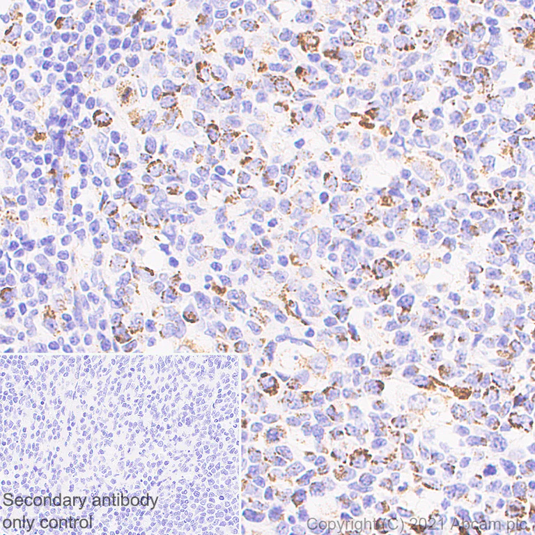 Immunohistochemistry (Formalin/PFA-fixed paraffin-embedded sections) - Anti-LRPPRC/GP130 antibody [EPR24052-38] (AB259927)