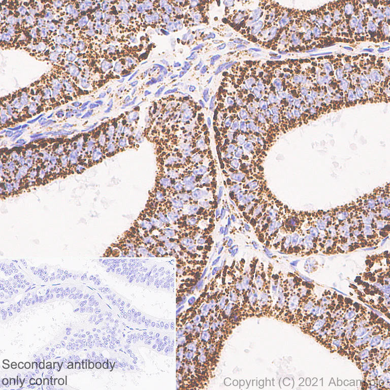 Immunohistochemistry (Formalin/PFA-fixed paraffin-embedded sections) - Anti-LRPPRC/GP130 antibody [EPR24052-38] (AB259927)