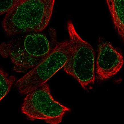 Immunocytochemistry/ Immunofluorescence - Anti-LRR-1 antibody (AB221772), expandable thumbnail