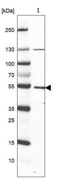 Western blot - Anti-LRR-1 antibody (AB221772), expandable thumbnail