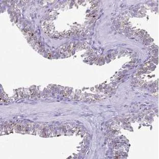 Immunohistochemistry (Formalin/PFA-fixed paraffin-embedded sections) - Anti-LRRC10B antibody (AB188260)
