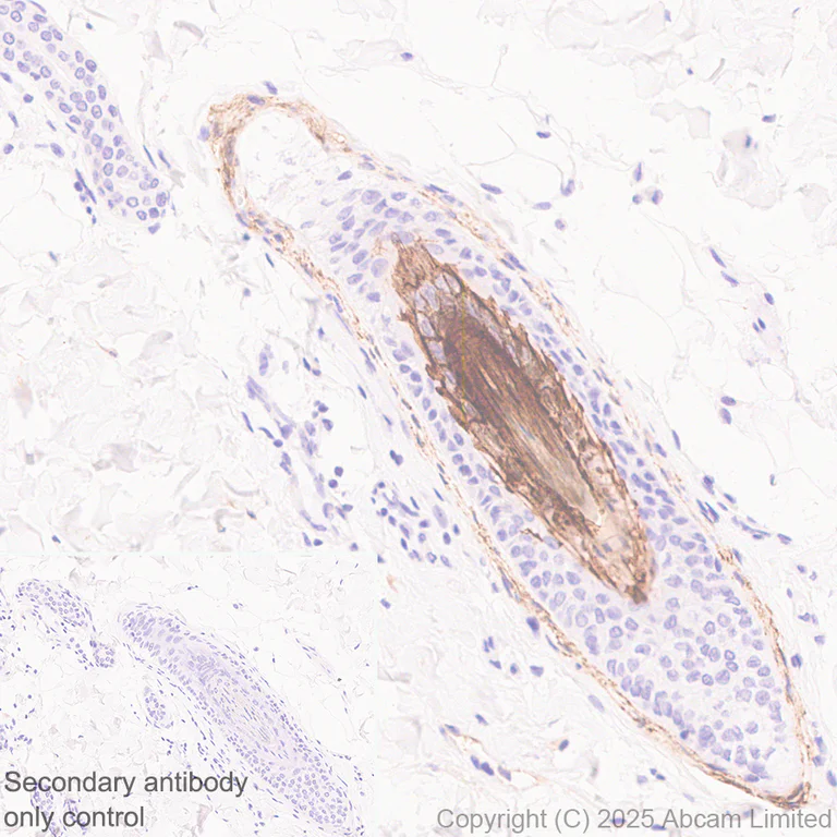 Immunohistochemistry (Formalin/PFA-fixed paraffin-embedded sections) - Anti-LRRC15 antibody [EPR29912-530] (AB324485)