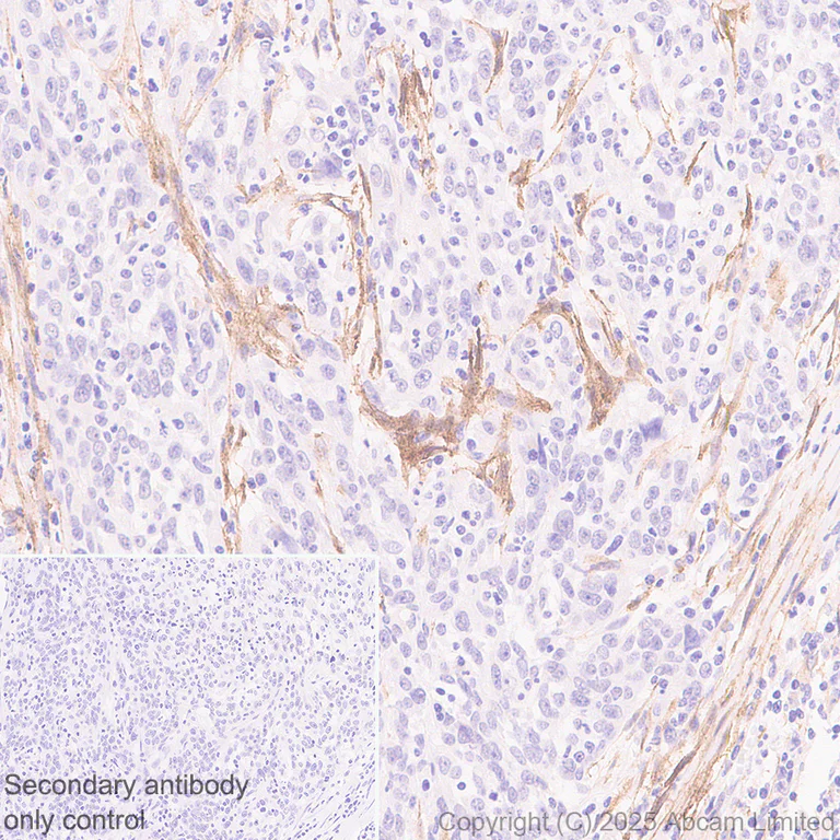 Immunohistochemistry (Formalin/PFA-fixed paraffin-embedded sections) - Anti-LRRC15 antibody [EPR29912-530] (AB324485)