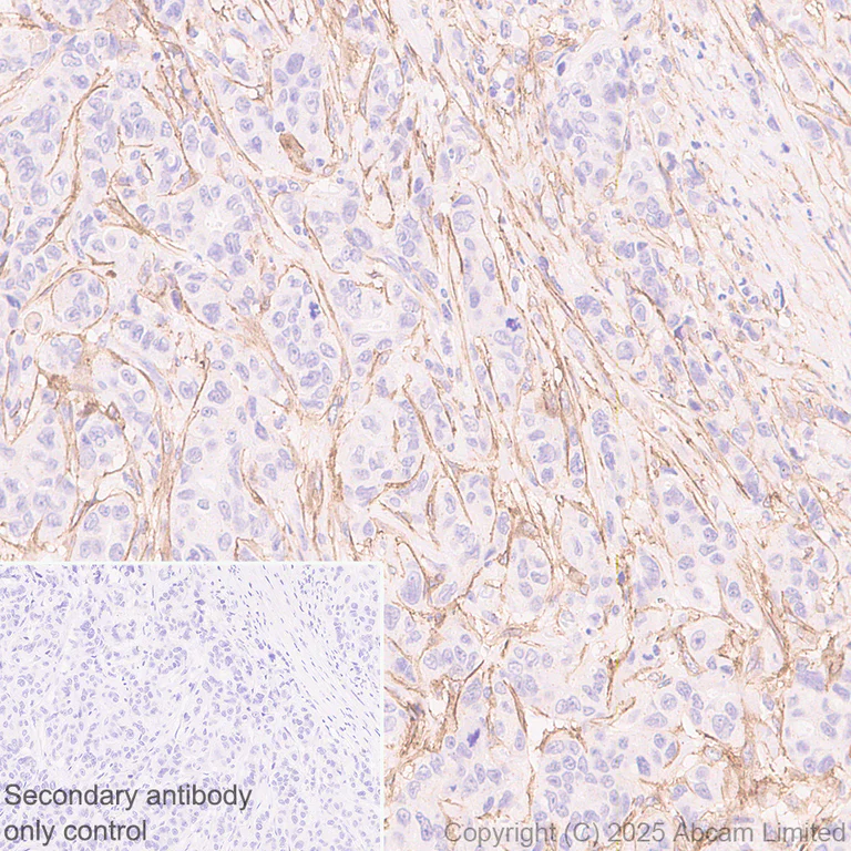 Immunohistochemistry (Formalin/PFA-fixed paraffin-embedded sections) - Anti-LRRC15 antibody [EPR29912-530] (AB324485)