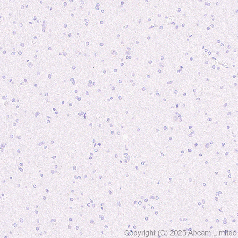 Immunohistochemistry (Formalin/PFA-fixed paraffin-embedded sections) - Anti-LRRC15 antibody [EPR29912-530] (AB324485)