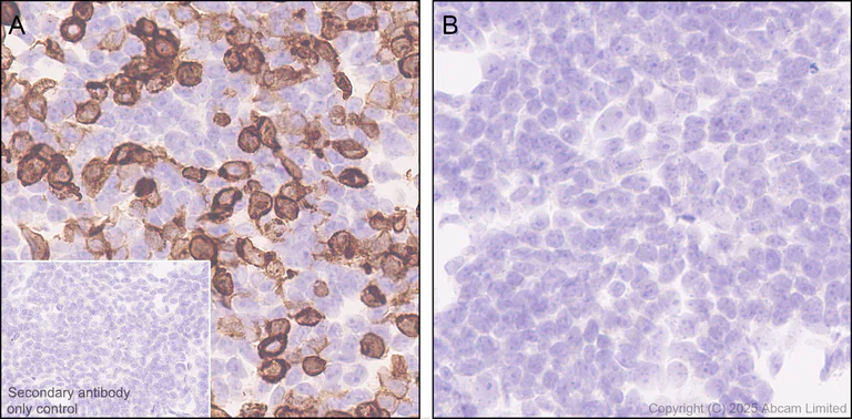 Immunohistochemistry (Formalin/PFA-fixed paraffin-embedded sections) - Anti-LRRC15 antibody [EPR29912-530] (AB324485)