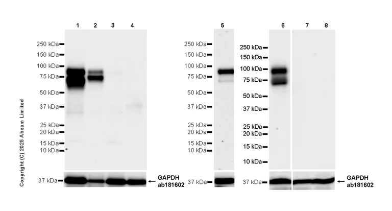 Western blot - Anti-LRRC15 antibody [EPR29912-530] (AB324485)