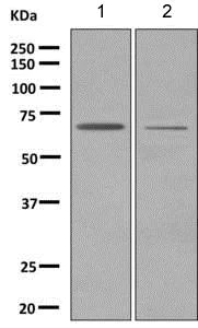 Western blot - Anti-LRRC15 antibody [EPR8188(2)] (AB150376)