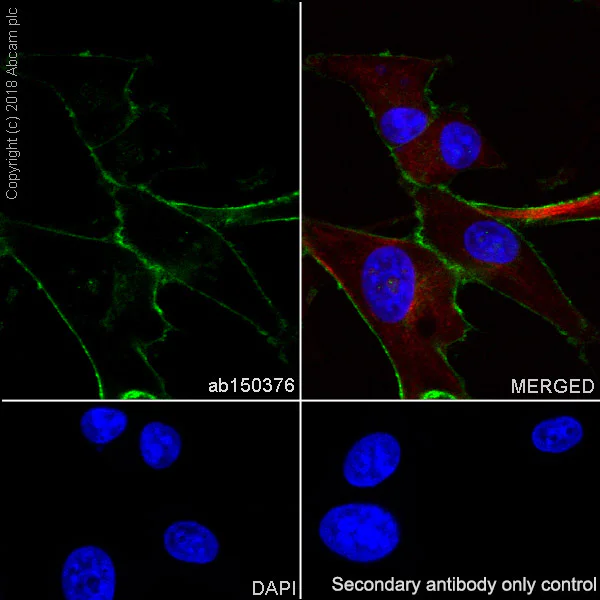 Immunocytochemistry/ Immunofluorescence - Anti-LRRC15 antibody [EPR8188(2)] - BSA and Azide free (AB209427)