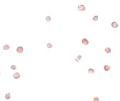 Immunocytochemistry - Anti-LRRC19 antibody (AB106657)