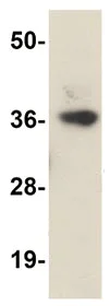 Western blot - Anti-LRRC19 antibody (AB106657)
