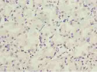 Immunohistochemistry (Formalin/PFA-fixed paraffin-embedded sections) - Anti-LRRC20 antibody (AB235521)