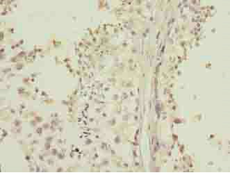 Immunohistochemistry (Formalin/PFA-fixed paraffin-embedded sections) - Anti-LRRC20 antibody (AB235521)