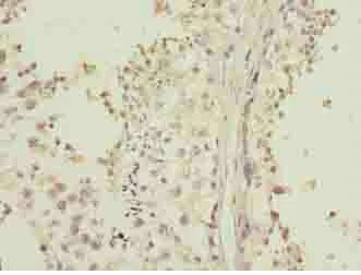 Immunohistochemistry (Formalin/PFA-fixed paraffin-embedded sections) - Anti-LRRC20 antibody (AB235521)