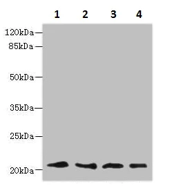 Western blot - Anti-LRRC20 antibody (AB235521)