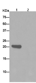 Immunoprecipitation - Anti-LRRC20 antibody [EP9977(2)] - BSA and Azide free (AB284840)