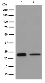 Western blot - Anti-LRRC20 antibody [EP9977(2)] - BSA and Azide free (AB284840)