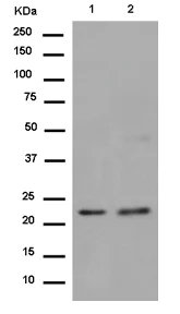 Western blot - Anti-LRRC20 antibody [EP9977(2)] - BSA and Azide free (AB284840)