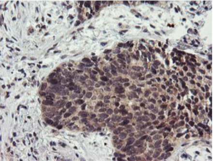 Immunohistochemistry (Formalin/PFA-fixed paraffin-embedded sections) - Anti-LRRC25/MAPA antibody [OTI1D9] (AB236395)