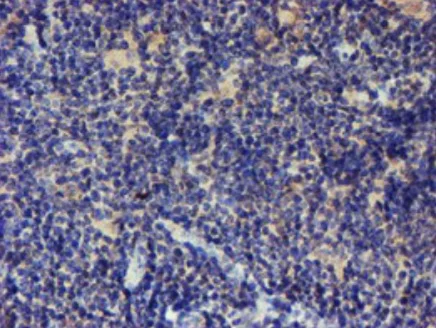 Immunohistochemistry (Formalin/PFA-fixed paraffin-embedded sections) - Anti-LRRC25/MAPA antibody [OTI1D9] (AB236395)