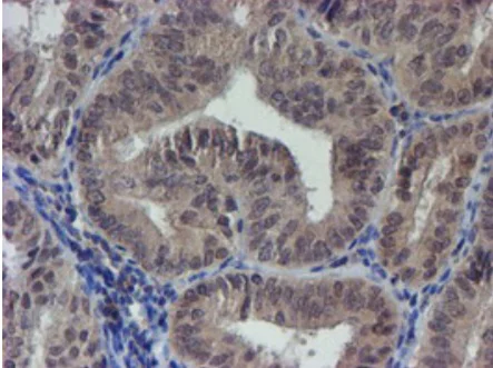 Immunohistochemistry (Formalin/PFA-fixed paraffin-embedded sections) - Anti-LRRC25/MAPA antibody [OTI1D9] (AB236395)