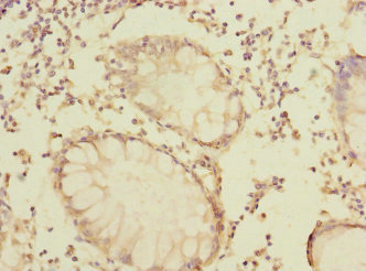 Immunohistochemistry (Formalin/PFA-fixed paraffin-embedded sections) - Anti-LRRC32 antibody (AB238727)