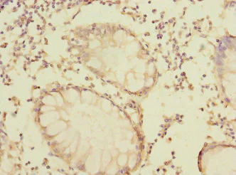 Immunohistochemistry (Formalin/PFA-fixed paraffin-embedded sections) - Anti-LRRC32 antibody (AB238727)