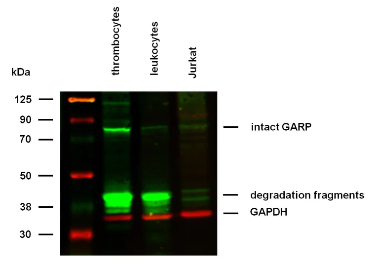 Western blot - Anti-LRRC32 antibody [GARP5] (AB194813)