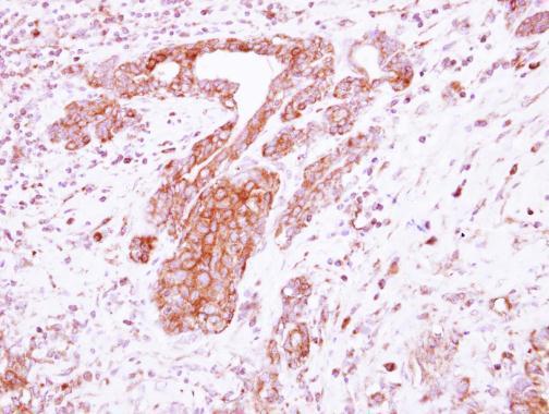 Immunohistochemistry (Formalin/PFA-fixed paraffin-embedded sections) - Anti-LRRC4C antibody (AB111572), expandable thumbnail