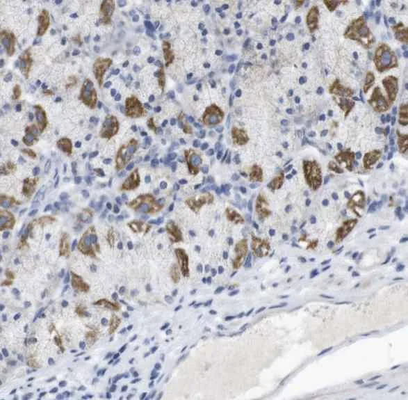 Immunohistochemistry (Formalin/PFA-fixed paraffin-embedded sections) - Anti-LRRC55 antibody (AB121412)