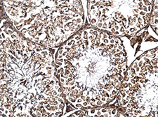 Immunohistochemistry (Formalin/PFA-fixed paraffin-embedded sections) - Anti-LRRC59 antibody (AB184143), expandable thumbnail