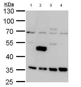 Western blot - Anti-LRRC59 antibody (AB184143), expandable thumbnail