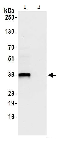 Immunoprecipitation - Anti-LRRC59 antibody (AB241588)