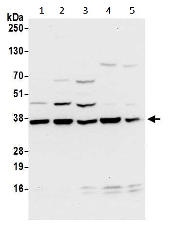 Western blot - Anti-LRRC59 antibody (AB241588)