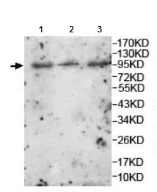 Western blot - Anti-LRRC8A antibody (AB157489)